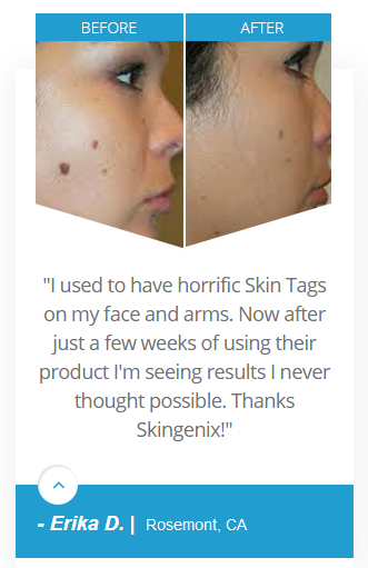 skingenix customer reviews
