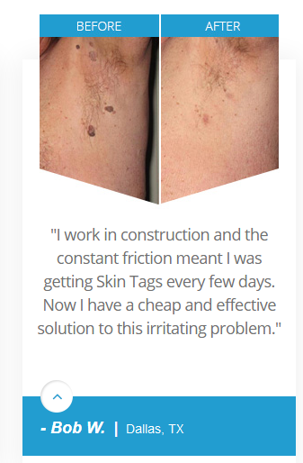 skingenix testimonial